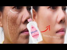 Baby Oil and Vaseline for skin whitening 10 shades, Removes wrinkles and dark Sports. - YouTube Baby Lotion, Facial Cream, Baby Oil, Fair Skin, Wrinkle Remover, Oils For Skin, Facial Care, Vaseline, Beauty Secrets