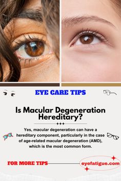 Learn about the genetic factors and causes of age-related macular degeneration (AMD). Find out if macular degeneration is hereditary and whether wet macular degeneration is genetic. Stay informed to protect your eye health. #MacularDegeneration #EyeHealth #GeneticFactors #HealthAwareness  This pin is not intended as medical advice. Consult a healthcare professional for any health concerns. Vision Health, Vision Loss, Genetic Testing, Immune Response, Cardiovascular Health, Blood Vessels, Health Awareness