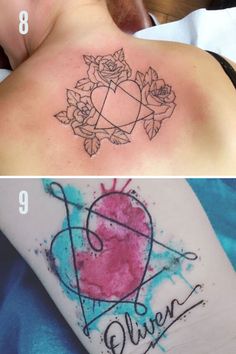 before and after tattoo removals on the back of a woman's shoulder, from left to right