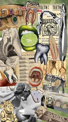 #dentistry #dental #teeth #tooth #vintage #dentist Dental Hygiene Wallpaper, Dental Backgrounds, Dentistry Wallpaper, Tooth Wallpaper, Dentist Advertising, Dentist Aesthetic, Vintage Dentist