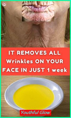 Discover the ultimate wrinkle remedies with this natural, fast-acting solution! Say goodbye to fine lines and wrinkles under eyes, around mouth, and on hands. Achieve a youthful glow quickly with this effective anti-aging remedy. #Wrinkle Remedies #NaturalSkincare #AntiAging #SkinCare #FastResults #Glowing Skin Wrinkle Remedies Face, Best Wrinkle Filler, Eyelid Wrinkles, Natural Wrinkle Remedies, Face Wrinkles Remedies, Wrinkle Prevention, Wrinkles Remedies, Home Remedies For Wrinkles