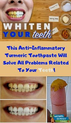 Make Teeth Whiter, Teeth Whitening Methods, Coconut Baking, Pasta Dental