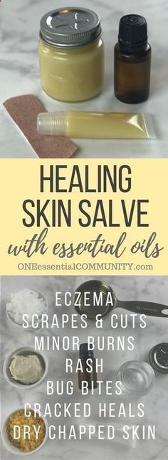 Essential Oil Healing, Healing Salve Recipe, Healing Skin, Homemade Essential Oil, Diy Kosmetik, Cracked Heels, Bug Bites