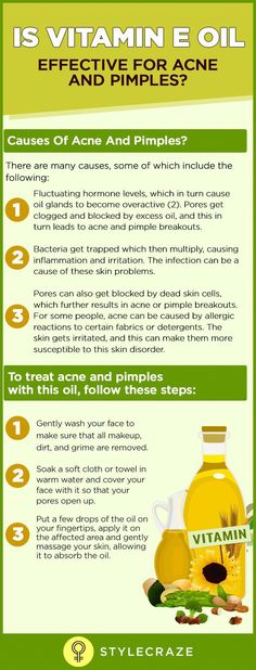 You can use vitamin E oil for acne as an alternative to chemical products with multiple ingredients. Learn more about how and why vitamin E works to heal acne. Vitamin E Oil For Skin, Oil For Skin, Acne Problem, Acne Free, Skin Remedies