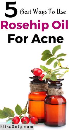 Juniper Berry Essential Oil, Exfoliate Skin, Oily Skin Acne, Acne Help, Skin Care Routine 30s, Diy Acne, Get Rid Of Acne, Rid Of Acne, Natural Acne Remedies