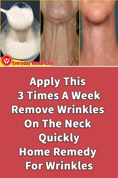 Applying this mask will help you Remove Wrinkles On Your Neck permanently and get tight and young skin. This mask is safe and natural, and it works for all t... Face Wrinkles Remedies, Wrinkles Remedies Face, Home Remedies For Wrinkles, Chest Wrinkles, Wrinkle Remedies, Wrinkle Free Skin, Diy Anti Aging, Neck Wrinkles, Skin Care Wrinkles