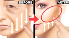 Fuller Cheeks, Saggy Cheeks, Eyes Bags, Facial Yoga Exercises, Sagging Cheeks, Muscles Of The Face