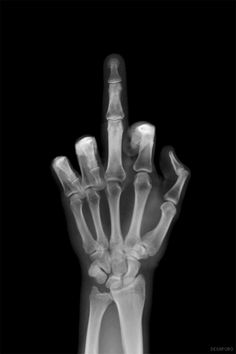 an x - ray image of the hand and wrist with text that reads raise ourselves and a middle finger