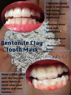 ... Bentonite Clay For Teeth, Clay Tooth, Aztec Clay, Healthy Healing, Tooth Whitening, Teeth Whitening Remedies, Whiten Teeth