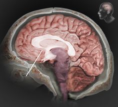 Traumatic Brain Injury A to Z - Interactive Brain-- Shows many different angles of brain, just click and learn about different parts and what symptoms damage to that area may cause. Brain Injuries, About Science, Brain Surgery, Speech Language Pathology