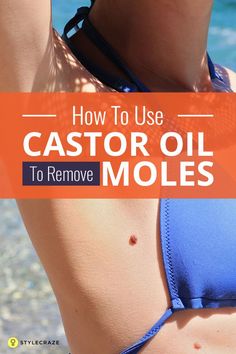 Remove Moles, Castor Oil Benefits, Skin Moles, Skin Growths, Mole Removal, Acne Scar Removal, Natural Cough Remedies, Oil Benefits, Oil Uses