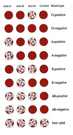 an image of different types of dots and their corresponding names in red, white, and black