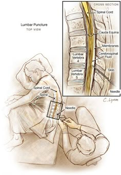 an image of a medical diagram showing the location of lumbar function