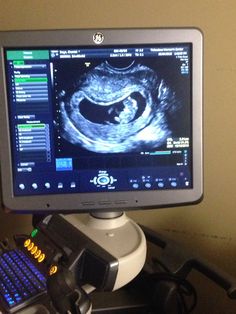 a computer monitor sitting on top of a desk