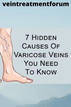 Your guide to the most qualified vein treatment specialists in your area! Whether you're suffering from the later conditions Varicose Veins Causes, Love Challenge, Need To Know, Conditioner