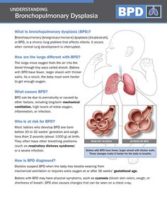 the bronchromy dysphasia is an organ that has been developed to help