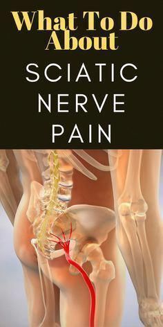 Sciatic Nerve Pain Relief, Inner Knee Pain, Sciatica Exercises, Sciatica Pain Relief, Back Pain Remedies, Nerve Pain Relief, Sciatic Nerve Pain, Knee Pain Relief, Sciatica Pain