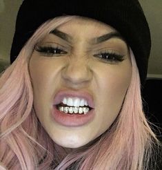 a woman with pink hair wearing a black beanie and braces on her teeth