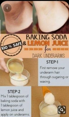 For Dark Underarms, Dark Armpits, Lemon Benefits, Dark Underarms, Baking Soda Shampoo, Diy Remedies, Natural Therapy, Skin Care Remedies, Diy Health