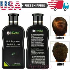 DEXE Anti-Hair Loss Shampoo Chinese Herbal Hair Regrowth For Men & Women 200ml Description #1 - 200 ml Anti-Hair Loss Shampoo Description:  1. This is a mild, concentrated shampoo with effective cleaning function that contains protein and plant extracts for nourishing and moisturizing scalp, leaving soft, shining gloss on the hair.  2. The herbal extract helps to rebuild hair structure, providing abundant water to the cuticle layer of the hair and the scalp, then solves split hair and broken hair problems, which will bring the hair a nourishing effect and silky feeling Features: * Hair shampoo is specially designed for Clean Hair & Prepare. is the first step based on anti-hair loss 3 steps of the protocol. * Hair serum and DHT shampoo removes from the scalp. It contains bio-active essentia Hair Regrowth For Men, Hair Regrowth Remedies, Herbal Hair Growth, Natural Hair Regrowth, Hair Growth Women, Hair Regrowth Treatments, Hair Growth Shampoo, Vitamins For Hair Growth, Healthy Hair Care