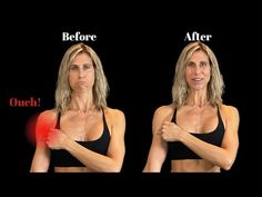 a woman is shown before and after her breast surgery