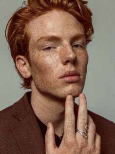 a red headed man with freckles on his face and hand to his chin