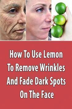 Remove Age Spots, Home Remedies For Wrinkles, Antiaging Skincare, Wrinkle Remedies, Wrinkle Free Skin, Dark Spots On Face, Spots On Face, Face Wrinkles, Deep Skin