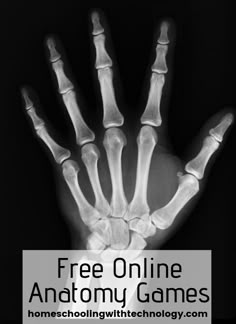 These anatomy games can be played by upper elementary through high school and are a great way to review or learn new material.#anatomygames #onlineanatomygames Open Fracture, Anatomy Lessons, Endocannabinoid System, Health Class, Health Savings Account, Bone Density, Homeschool Science, Science Classroom