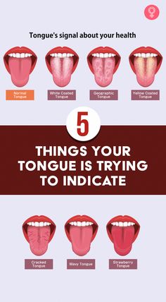 Things Your Tongue Is Trying  - To Tell You About Your Health by Paul King | This newsletter was created with Smore, an online tool for creating beautiful newsletters for educators, businesses and more Ayurvedic Tongue Chart, Tongue Cleaning Tips, What Does Your Tongue Tell You About Your Health, How To Get Rid Of The White Stuff On Tounge, Tongue Mapping Health, How To Get The White Stuff Off Your Tounge, Geographic Coating Tongue, Tounge Health Cracks, Tongue Cracks Meaning