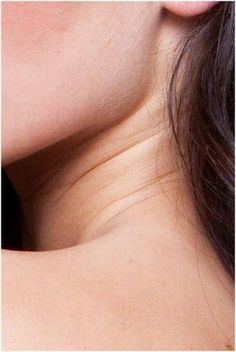 Needless to say, neck wrinkles are one physical attribute that none desires. Continue reading to understand how you can get rid of neck wrinkles and lines. Neck Wrinkles, Get Rid Of Blackheads, Wrinkle Cream, Teeth Whitening, Hair Removal, Face And Body, Glowing Skin