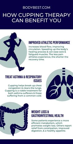 Abdominal Cupping Therapy, Hijama Cupping Therapy Benefits, Cupping Therapy Chart Trigger Points, Cupping Therapy Chart, Cupping Benefits