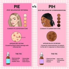 Skincare For Hyperpigmentation, Post Inflammatory Hyperpigmentation, Acne Face, Skin Care Routine Order, Natural Acne Remedies, Types Of Acne, Basic Skin Care Routine