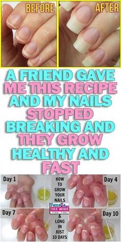 Rub Some Baking Soda On Your Nails And Watch What Happens� This Trick Will Change Your Life Pedicure Station, Tongue Health, Healthy Routine, Nail Health, Manicure Y Pedicure