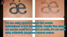 four pictures with different symbols on them and the caption that says, you can use removal