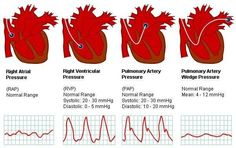 an image of the human heart and its corresponding functions in different stages of life cycle