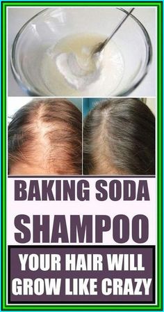 Baking Soda Shampoo, Healthy Natural Hair, For Hair Growth, Natural Hair Growth, Strong Hair, Grow Hair, Simple Tricks