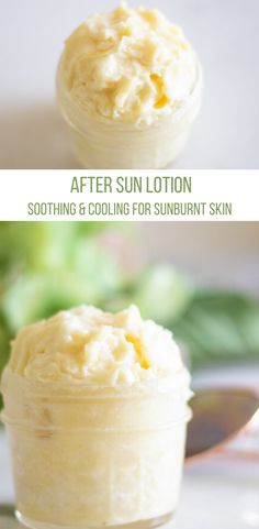 Sunburn Lotion, Sunburn Cream, Easy Diy Lotion, Homemade Face Lotion, How To Treat Sunburn, After Sun Lotion, Diy Teen, Homemade Lip Balm Recipe, Lotion Bars Diy