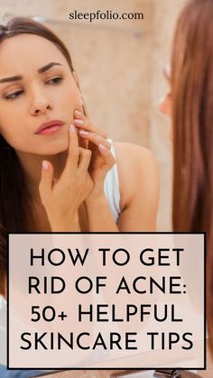 THIS Gets Rid of Acne Fast What Causes Acne, Different Types Of Acne, Tips Diet, Natural Acne, Types Of Acne