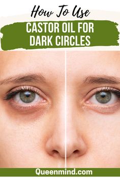 Struggling with dark circles? Discover how to use castor oil to brighten and rejuvenate the delicate skin around your eyes. This natural remedy is packed with benefits to help reduce the appearance of dark circles and nourish your skin. 🌟👁️ #CastorOil #DarkCircles #EyeCare #NaturalRemedies #SkincareTips #BeautyHacks #DarkCircleTreatment #CastorOilBenefits #NaturalBeauty #SkincareRoutine Coffee Eye Cream, Regrow Thinning Hair, Plump Lips Naturally, Diy Eye Cream, Fresh Aloe Vera Gel, Castor Oil Benefits, Fresh Aloe Vera, Diy Beauty Treatments, Dark Eye Circles