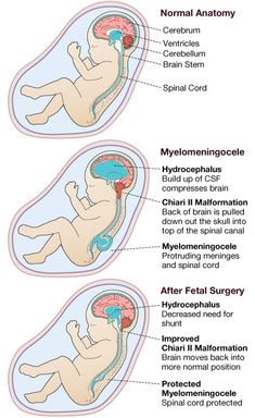 two diagrams showing the different stages of an infant's brain and how it works