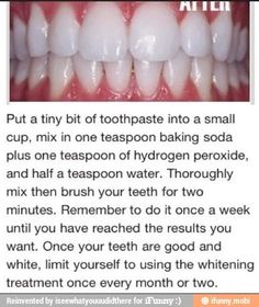 Whiten Teeth At Home, Baking Soda Teeth, Natural Teeth Whitening Remedies, Teeth Whitening Methods, Teeth Whitening Homemade, Teeth Whitening Remedies, Teeth Whitening Diy, Cleaning Advice, Whiten Teeth