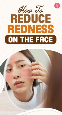 Ever Gotten Red Splotches on Your Skin? This May Be Why Natural Redness Relief Face, Remedies For Redness On Face, How To Get Rid Of Red Face, Red Skin Remedies Faces, How To Help Redness On Face, How To Cover Up Redness On Face, Face Itching Remedies, Skin Care Reduce Redness, How To Get Rid Of Face Redness