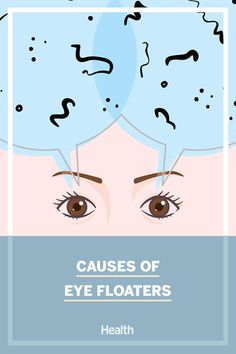 What Causes Eye Floaters, Eye Floaters Causes, Eye Floaters, Chesty Cough, Eye Facts, Eye Twitching, Home Remedy For Cough, Cold Sores Remedies, Healthy Eyes