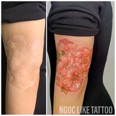 before and after photos of tattoo removals on the arm, with flowers in bloom