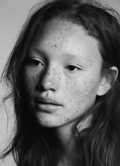 a black and white photo of a woman with freckles on her face