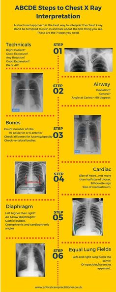 the anatomy of chest and chest with instructions on how to use it for medical purposes