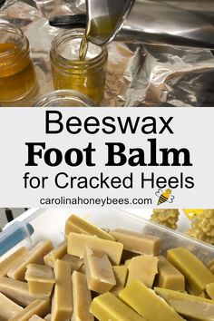 beeswax foot balm for cracked heels is an easy way to keep your feet fresh