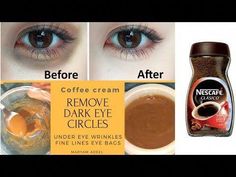 #MaryamAdeel #coffeeeyecream, darkcirclecream Dark Circle Remedies Overnight, Dark Circles Diy, Remove Dark Eye Circles, Coffee Eye Cream, Eyes Wrinkles, Dark Circles Around Eyes, Coffee Mask, Diy Eye Cream