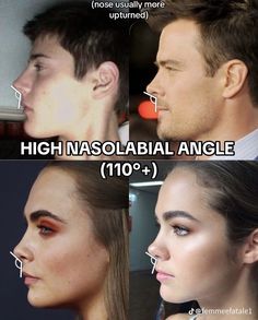 Male Jaw Filler, Man With Big Nose, Male Nose Job, Aquiline Nose Man, Male Nose Job Before And After, Male Face Shapes, Face Topology, Jaw Reduction Surgery, Facial Bones