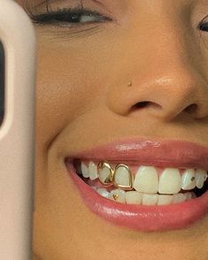 a close up of a woman with braces on her teeth holding a cell phone